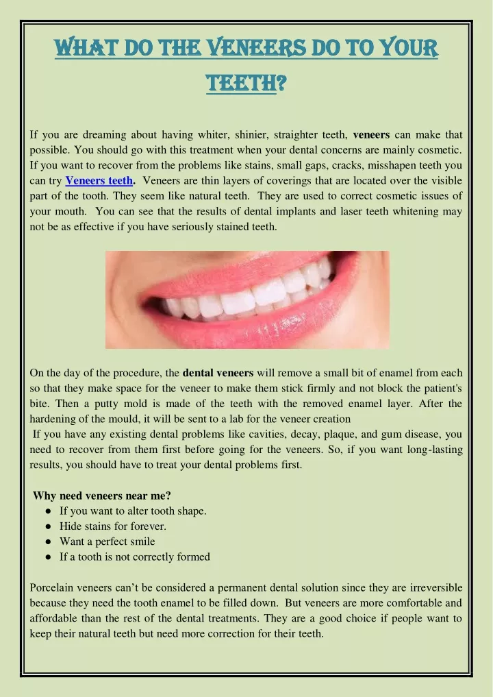 what what do the veneers do to your