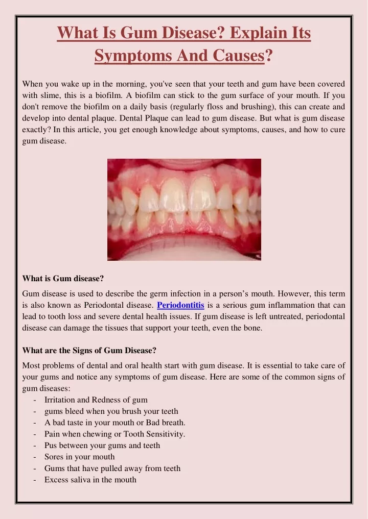 PPT - What Is Gum Disease? Explain Its Symptoms And Causes? PowerPoint ...