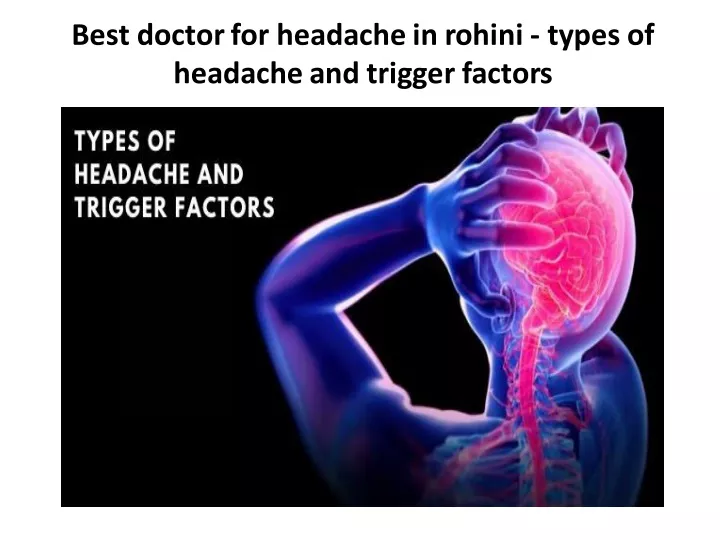 best doctor for headache in rohini types