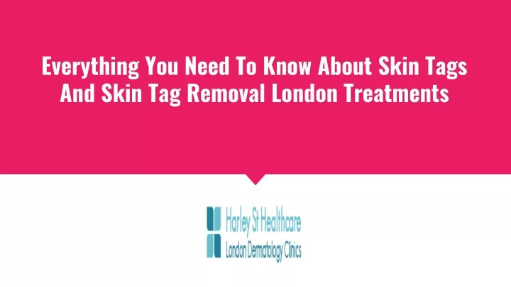 everything you need to know about skin tags and skin tag removal london treatments