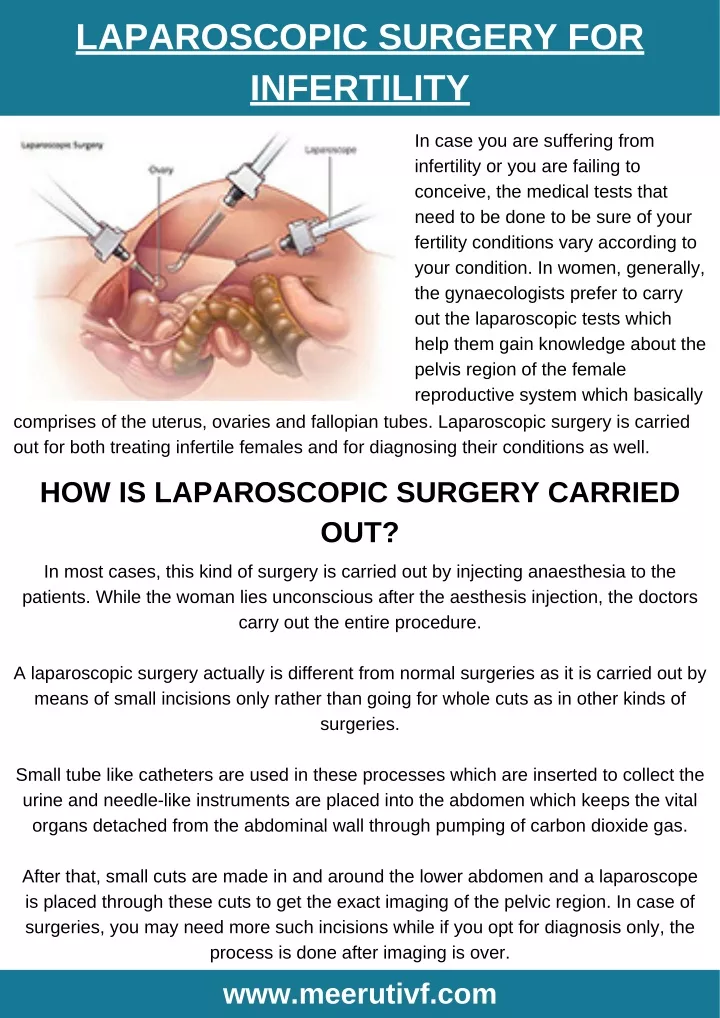 laparoscopic surgery for infertility