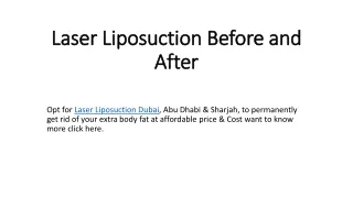 laser liposuction before and after