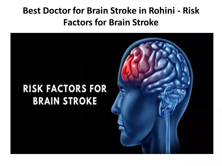 best doctor for brain stroke in rohini risk