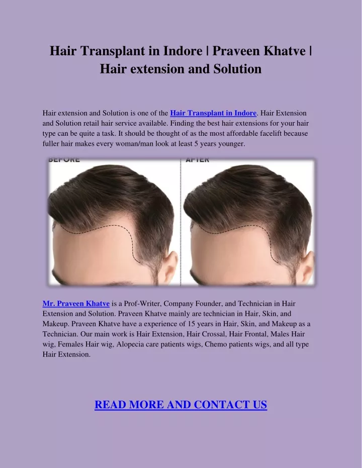 hair transplant in indore praveen khatve hair