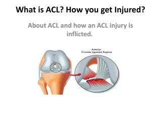 what is acl how you get injured