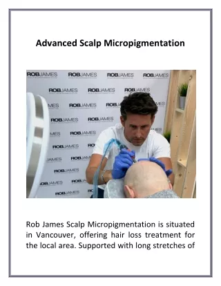 advanced scalp micropigmentation