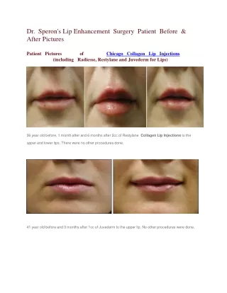 Lip Enhancement Surgery Patient Before & After Pictures