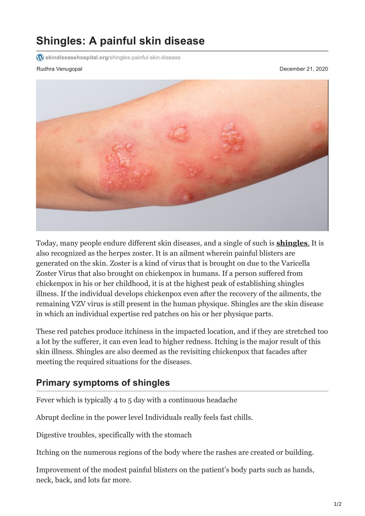 shingles a painful skin disease