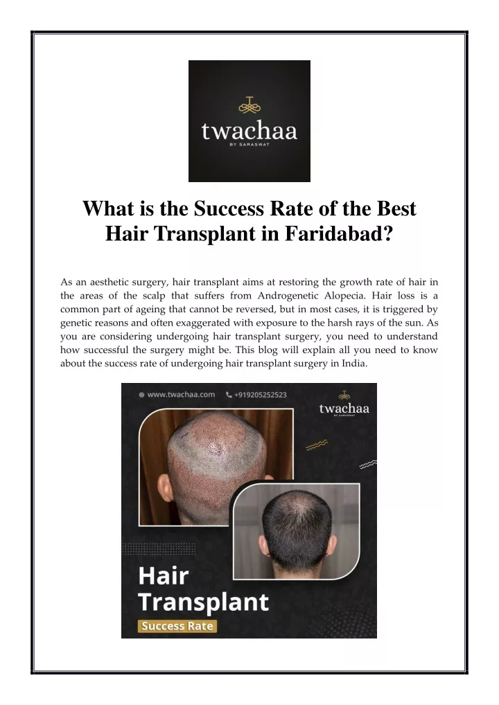 what is the success rate of the best hair