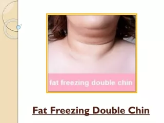Facts To Know About Fat Freezing A Double Chin