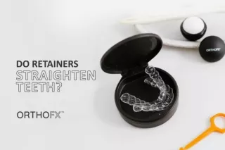 Do Retainers Straighten Teeth? | Teeth Straightening Treatment | OrthoFX