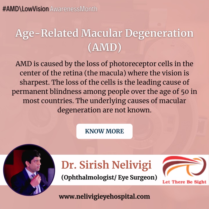 amd is caused by the loss of photoreceptor cells