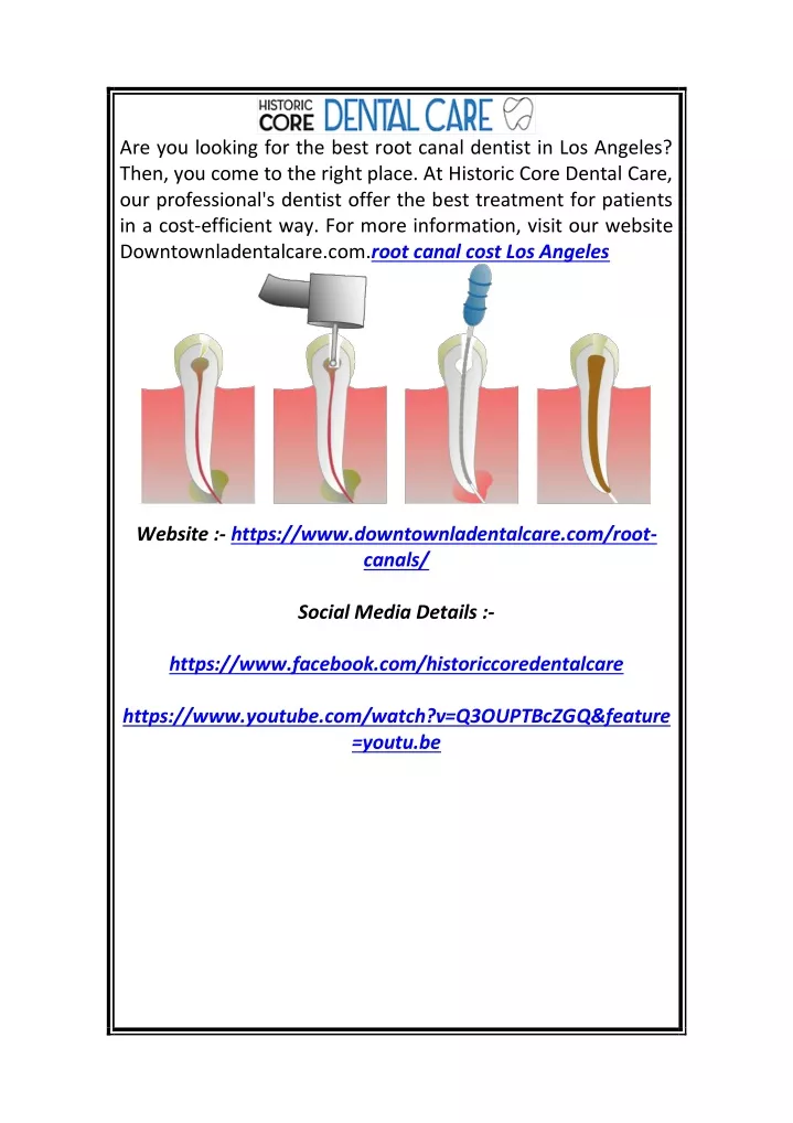 are you looking for the best root canal dentist