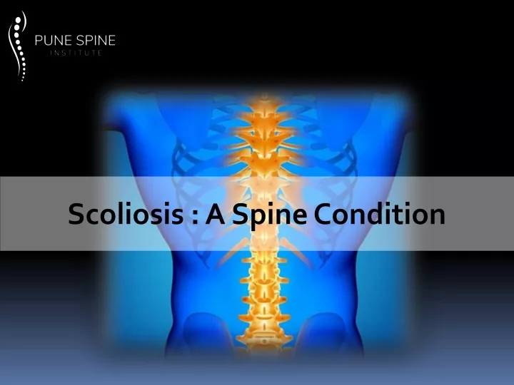scoliosis a spine condition