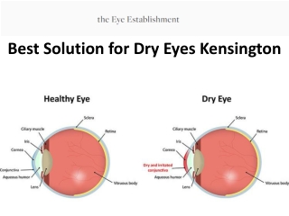 best solution for dry eyes kensington