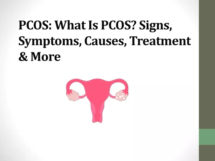 pcos what is pcos signs symptoms causes treatment more