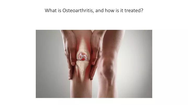 what is osteoarthritis and how is it treated