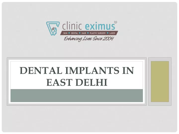 dental implants in east delhi
