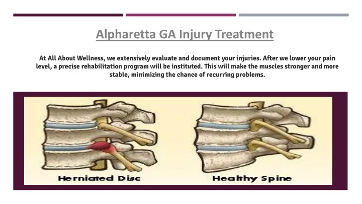 alpharetta ga injury treatment
