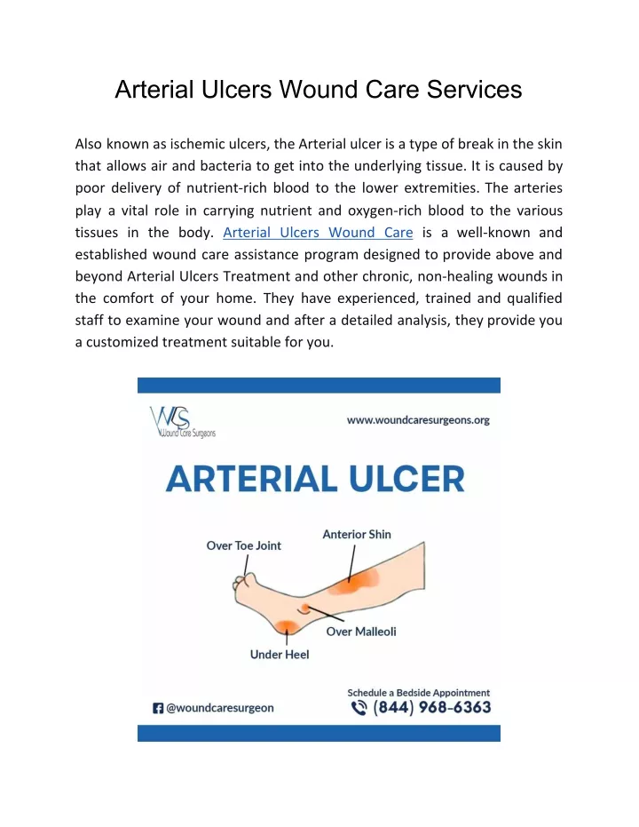 arterial ulcers wound care services