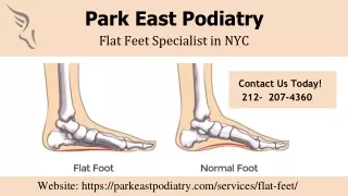 Flat Feet Specialist in NYC | Top-Rated Podiatrists | Park East Podiatry