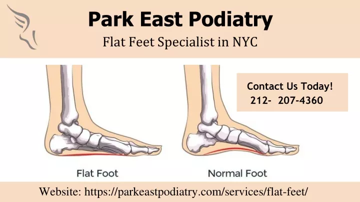 park east podiatry flat feet specialist in nyc