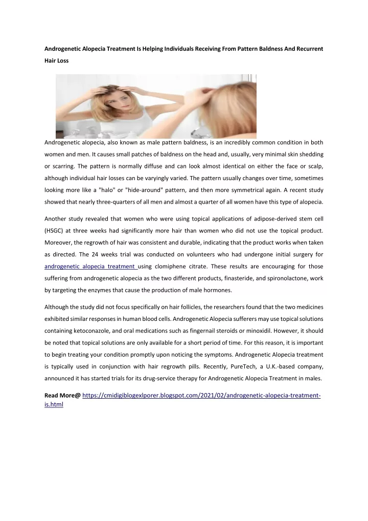 androgenetic alopecia treatment is helping