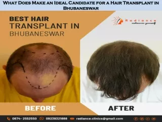 What Does Make an Ideal Candidate for a Hair Transplant in Bhubaneswar