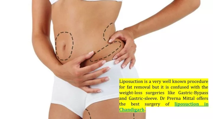 liposuction is a very well known procedure
