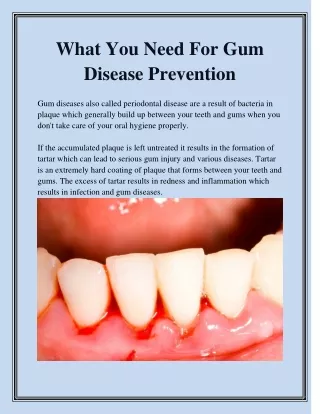 What You Need For Gum Disease Prevention