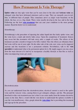 how permanent is vein therapy