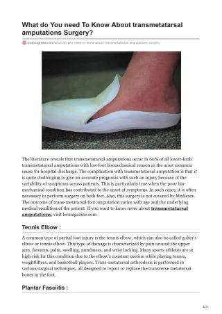 what do you need to know about transmetatarsal