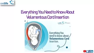 Everything You Need to Know About Velamentous Cord Insertion