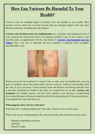 how can varicose be harmful to your health