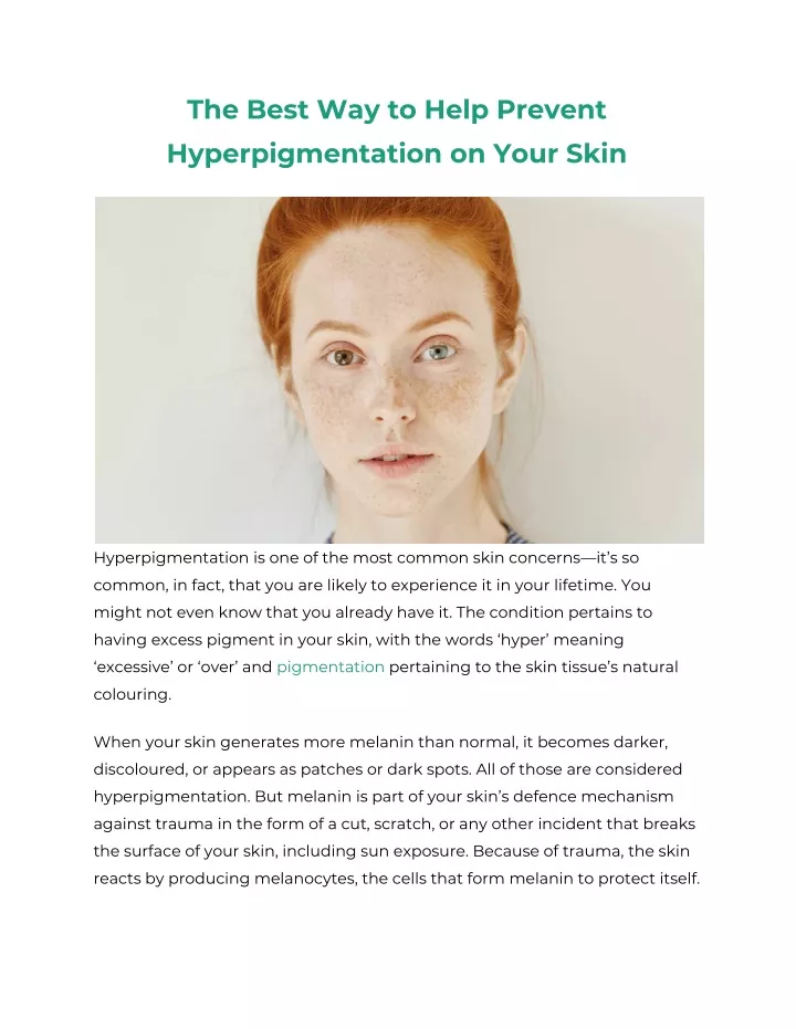 the best way to help prevent hyperpigmentation