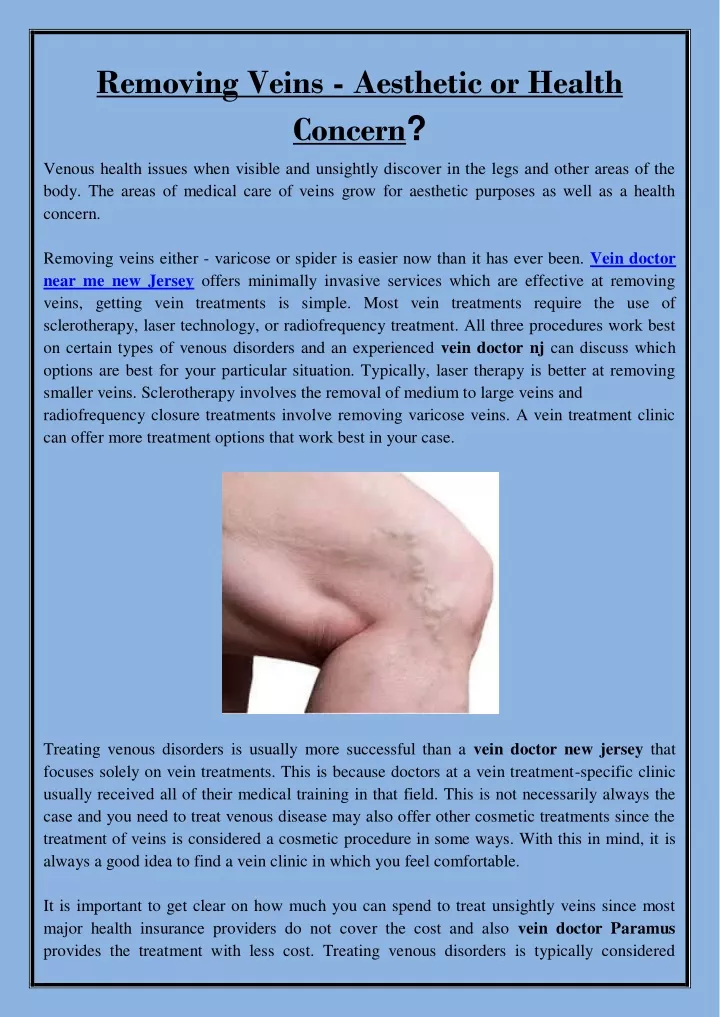 removing veins aesthetic or health concern