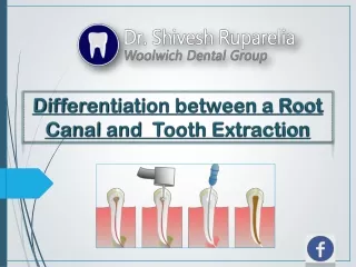 Differentiation Between A Root Canal and Tooth Extraction