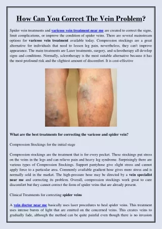how can you correct the vein problem