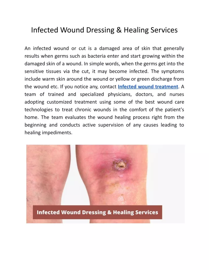 infected wound dressing healing services
