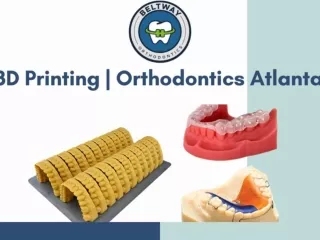 3D Printing | Orthodontics Atlanta