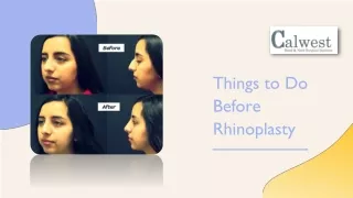 Things to Do Before Rhinoplasty