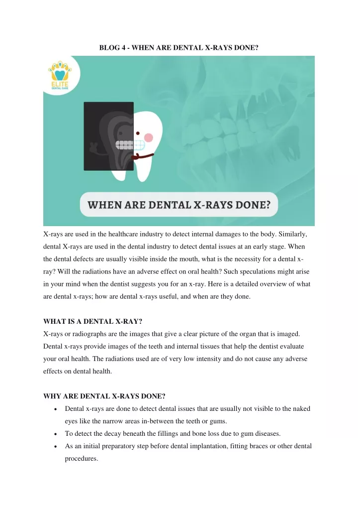 blog 4 when are dental x rays done