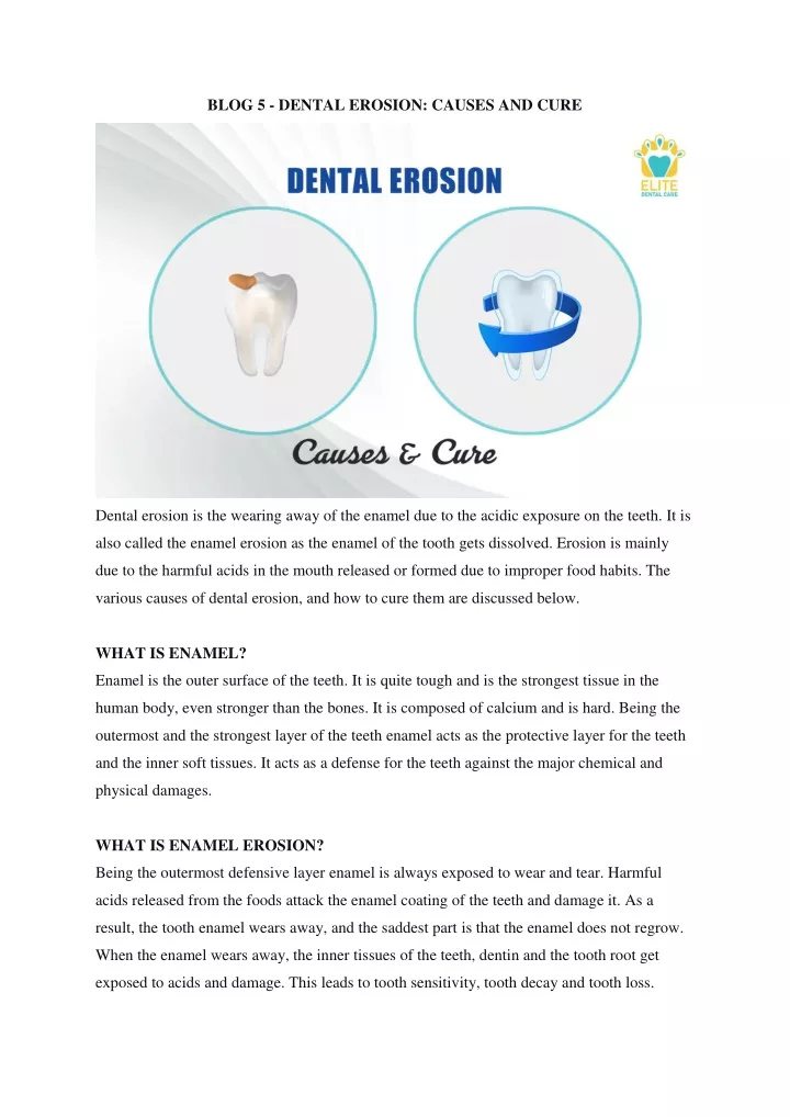 blog 5 dental erosion causes and cure