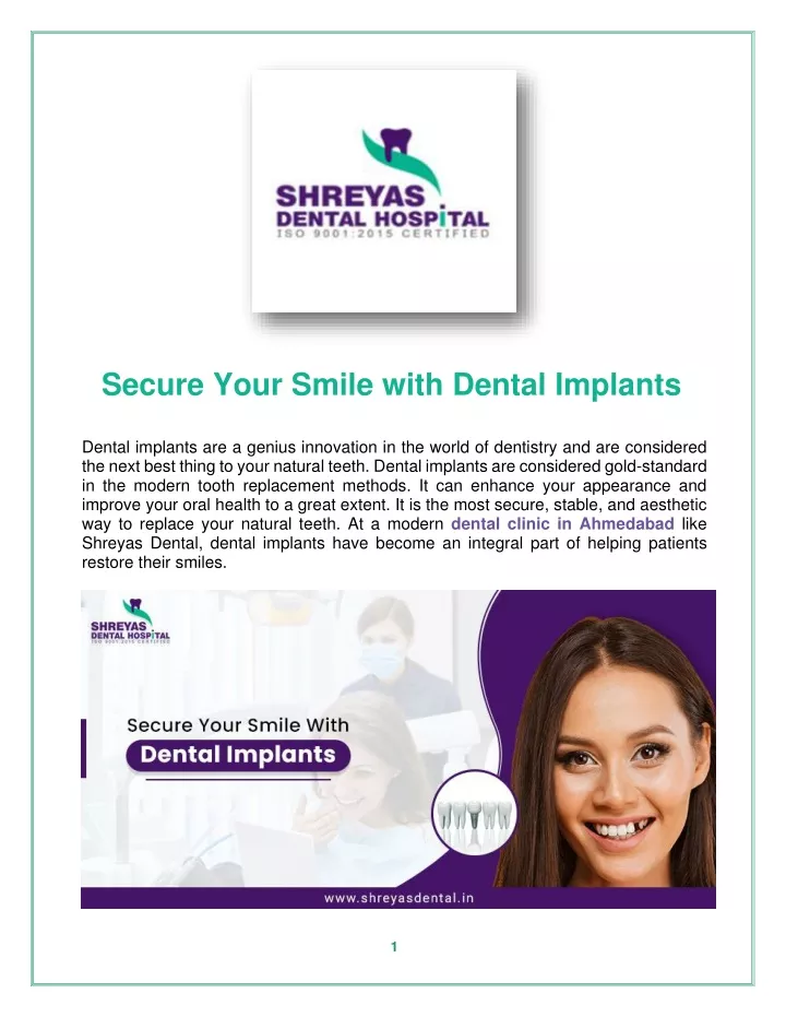 secure your smile with dental implants dental