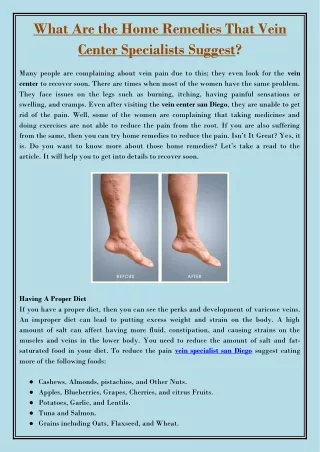 what are the home remedies that vein center
