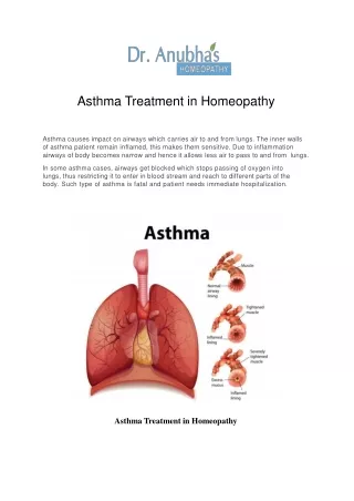 Asthma Treatment in Homeopathy - Dr. Anubha's Homeopathy Clinic International
