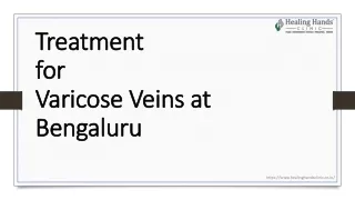 Best Treatment for Varicose Veins at Bengaluru