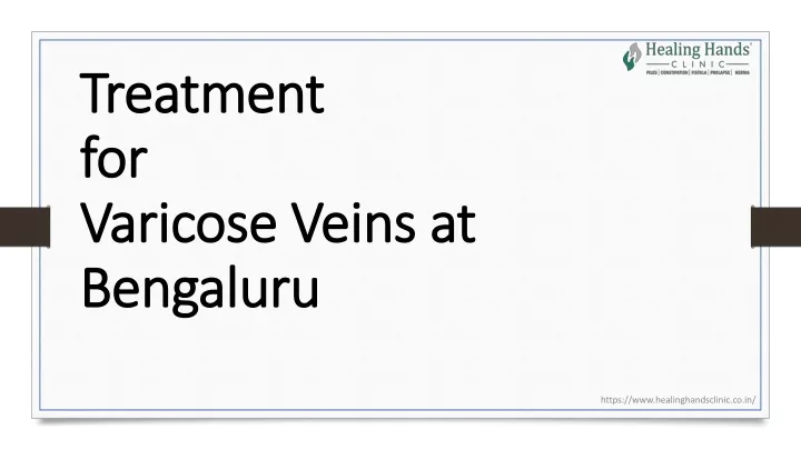 treatment for varicose veins at bengaluru