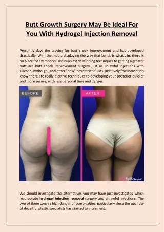 Butt Growth Surgery May Be Ideal For You With Hydrogel Injection Removal