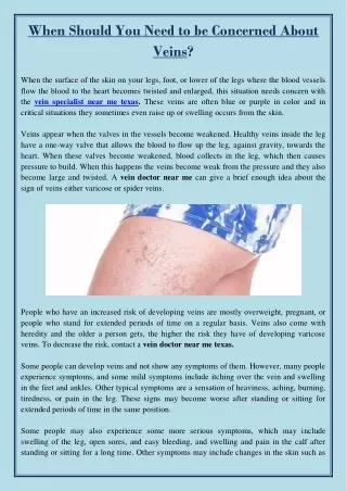 when should you need to be concerned about veins